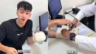Gero Arias muestra cómo evoluciona su mano a dos semanas de su accidente: "Este dedo no lo siento" 