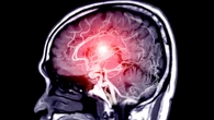 Un mito desmontado: el deterioro cognitivo es el mismo independientemente de tu nivel educativo