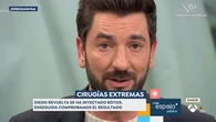 Diego Revuelta se somete a un tratamiento con bótox y muestra el resultado: "¡Pero si estoy igual!"