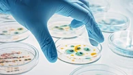 Un gen hace resistentes a las superbacterias y se extiende por el mundo: qué especies lo poseen y qué enfermedades causan
