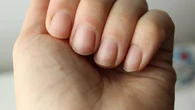 El aspecto de tus uñas te permite saber cuánto vivirás, según Harvard