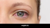El síndrome silencioso más común en mujeres: seca los ojos, la boca y provoca cansancio 