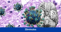 Algunas de las secuelas de la covid-19 son más frecuentes y persistentes en las mujeres, según un estudio