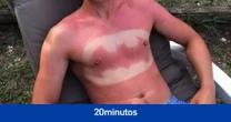 Científicos crean un protector solar que ofrece más protección UV contra las quemaduras solares