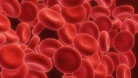 ¿Cuántos tipos de hemofilia hay? ¿Se puede curar? Todo sobre una dolencia que afecta a 3.000 personas en España