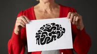 Así podría propagarse la proteína clave del Alzheimer en el cerebro