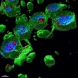 La enigmática huella de los microplásticos en la salud: “Se desconocen los efectos a largo plazo”