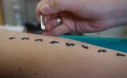 ¿Cómo se diagnostican las enfermedades alérgicas?
