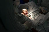Por qué es mejor (siempre que sea posible) un parto vaginal: la cesárea deja huella en la salud del bebé