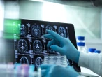 Más allá de la subjetividad: cómo la tecnología pretende mejorar los diagnósticos psiquiátricos