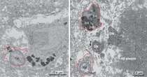 Descubierto el mecanismo de la “microglía oscura”, una posible causa del alzhéimer