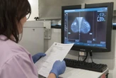 Un ensayo pionero alumbra alternativas de detección precoz del cáncer de mama cuando la mamografía se hace insuficiente