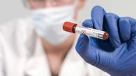 La Covid persistente es ya una enfermedad “real” y crónica para el sistema sanitario público