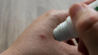 Los colores que no debes usar para evitar las picaduras de los mosquitos este verano: comprobado por la ciencia
