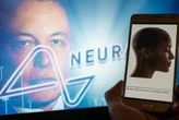 Elon Musk's Neuralink has thousands of people lined up for a brain chip implant. Here's what we know about the surgery that replaces a portion of your skull.
