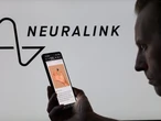 Elon Musk gives an update on Neuralink's brain-chip business. These are 5 things you can expect in the near future.