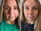 I get Botox as often as I can afford it. My aging face started to distract me on work calls — the cost is worth every penny.