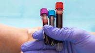 Forget 'biological age' tests &mdash; longevity experts are using an $800 under-the-radar blood test to measure aging in real-time