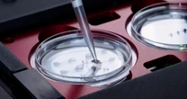 La IA ya elige espermatozoides y hace más efectiva la reproducción asistida
