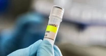 La Secretaría de Salud emite aviso epidemiológico por el brote multinacional de hantavirus