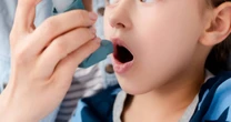 食物アレルギーとの併発が多い、乳児アトピー性皮膚炎とぜんそく、アレルギー性鼻炎をコントロールするには