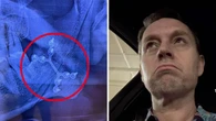 Aussie A-lister reveals staggering medical bills after near-death fall