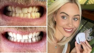 This 10-minute teeth whitening kit with more than 800 reviews has hit its lowest price ever