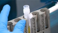 Major trial aims to detect Alzheimer’s years earlier