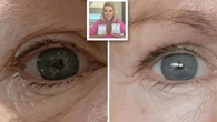 Celebrity-loved $29 eye cream with more than 1,500 glowing reviews is wowing shoppers