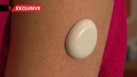 New patch set to revolutionise IVF treatment