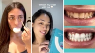Smilie’s $219 whitening kit is now just $119 — and shoppers say it works in under a week