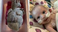 ‘Mini hearts’: New research could help save little girl’s heart