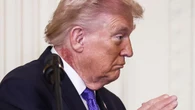 Large rash on Trump's neck prompts health questions