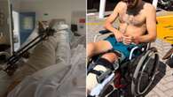 Emotional Aussie lays bare shattering reality after endless surgeries