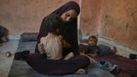How is starvation treated?