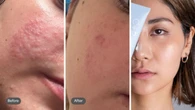Shoppers obsessed with sensitive-skin friendly products : ‘Obsessed, it calms my reactive skin’