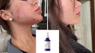 Fan-favourite La Roche-Posay dark spot serum slashed in price to under $55