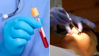 Patients urged to get blood tests after shocking find at Sydney dental practice