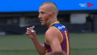 Lions hero reveals he lost hearing after scary head knock