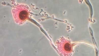 Fungi that can ‘eat you from the inside out’ could be headed for Australia