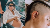 ‘Take this seriously’: Young mum’s plea after severe headache led to cancer diagnosis