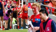Mass carnage as stars get wiped out in bruising encounter