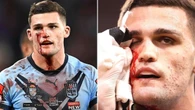 ‘Absolute joke’: Disturbing scenes as NSW halfback spurts blood for 30 minutes