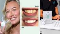 At-home teeth whitening kit thousands of Aussies swear by now 70 per off this EOFY