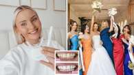 Brides are turning to this at-home teeth whitening kit that dentists approve of