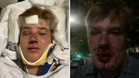 Jack thought he was going on a date. Instead, he was viciously bashed by eight kids in an Aussie park