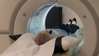 World-first Australian lung scanning technology approved: ‘Game-changer’