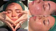 The facial treatment that experts say ‘is better than snail mucin’