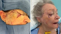 Dismissed by GPs, one decision may have saved woman’s life