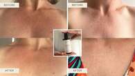 Body serum sells out in just eight hours: The results are unbelievable 